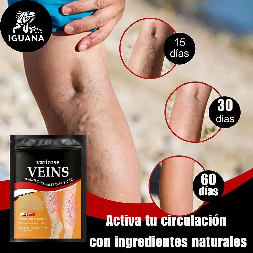 Parches para Venas Varicosas