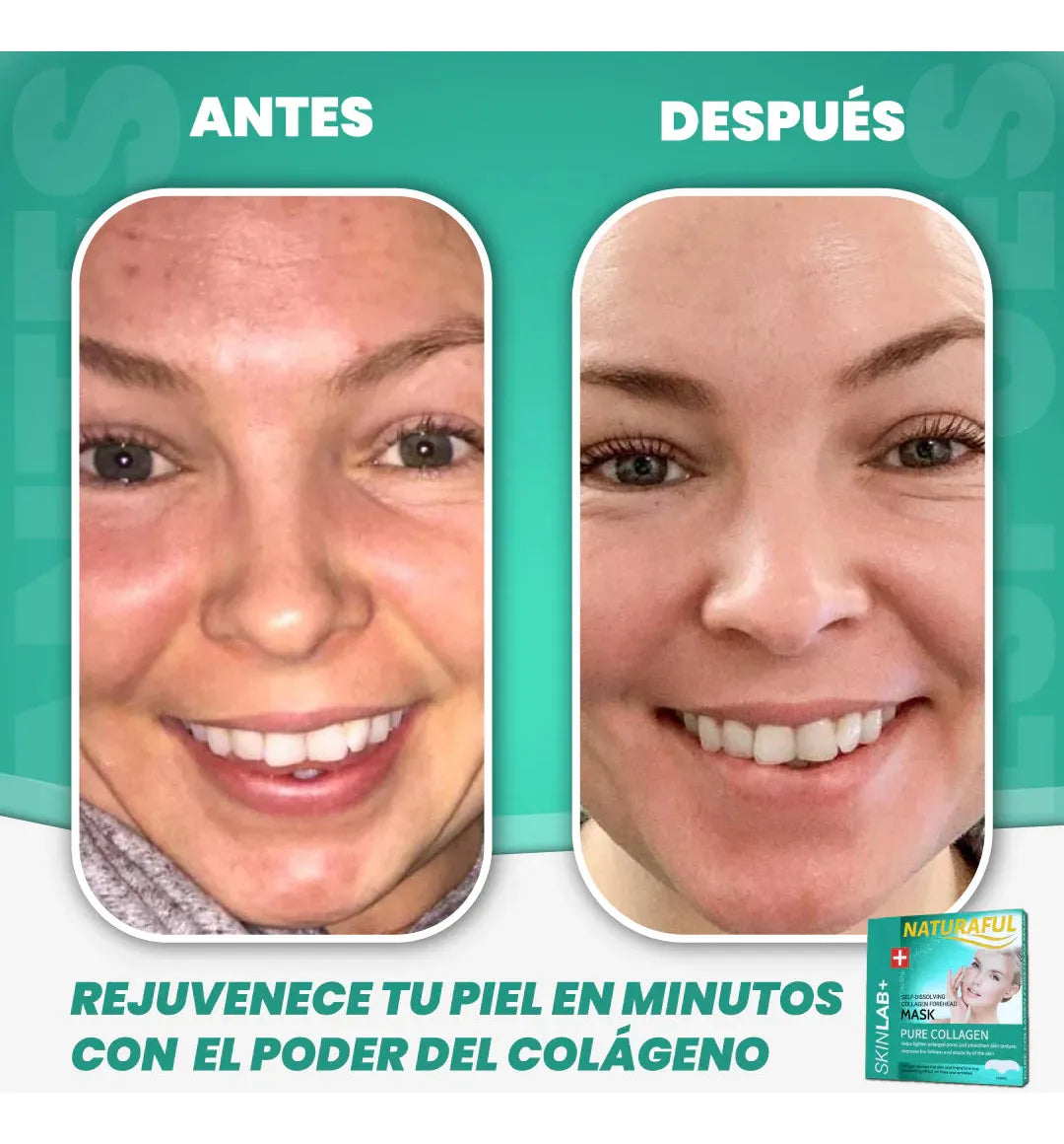 Parches De Colageno Absorbentes